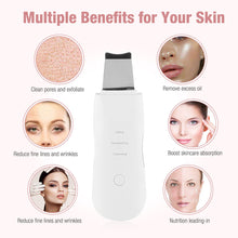 Load image into Gallery viewer, Ultrasonic Skin Scrubber Deep Face Cleaning Machine Peeling Shovel Facial Pore Cleaner Face Skin Scrubber Lift Beauty Instrument Ultrasonic Facial Scrubber Pore Blackhead Remover Spatula Deep Skin Spa
