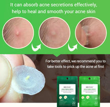 Load image into Gallery viewer, Tea Tree Acne Patch Fades Acne Marks and Ultra-thin
