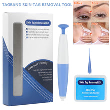 Load image into Gallery viewer, Skin Tag Removal Kit Home Use Mole Wart Remover Micro Band Skin Tag Treatment Tool Easy To Clean Skin Care Tool
