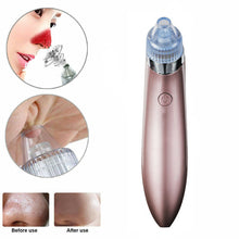 Load image into Gallery viewer, Electric Blackhead Vacuum Pore Cleaner Acne Pimple Remover Strong Suction Tool Electric Blackhead Remover Pore Vacuum Suction Diamond Dermabrasion Face Cleaner
