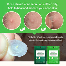 Load image into Gallery viewer, Tea Tree Acne Patch Fades Acne Marks and Ultra-thin
