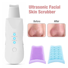 Load image into Gallery viewer, Ultrasonic Skin Scrubber Deep Face Cleaning Machine Peeling Shovel Facial Pore Cleaner Face Skin Scrubber Lift Beauty Instrument Ultrasonic Facial Scrubber Pore Blackhead Remover Spatula Deep Skin Spa
