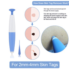 Load image into Gallery viewer, Skin Tag Removal Kit Home Use Mole Wart Remover Micro Band Skin Tag Treatment Tool Easy To Clean Skin Care Tool
