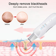 Load image into Gallery viewer, Ultrasonic Skin Scrubber Deep Face Cleaning Machine Peeling Shovel Facial Pore Cleaner Face Skin Scrubber Lift Beauty Instrument Ultrasonic Facial Scrubber Pore Blackhead Remover Spatula Deep Skin Spa
