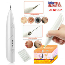 Load image into Gallery viewer, Ion Laser Freckle Skin Mole Dark Spot Remover Face Wart Tag Tattoo Removal Pen
