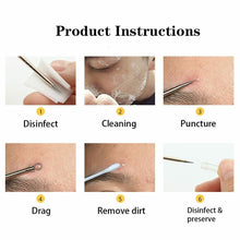 Load image into Gallery viewer, Ear Wax Remover Spoon Earwax Picker And Pimple Blackhead Remover Tools - COMBO KIT
