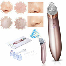 Load image into Gallery viewer, Electric Blackhead Vacuum Pore Cleaner Acne Pimple Remover Strong Suction Tool Electric Blackhead Remover Pore Vacuum Suction Diamond Dermabrasion Face Cleaner
